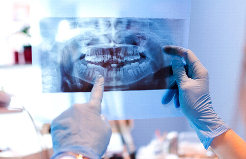 dentist reviewing patients x-ray in office