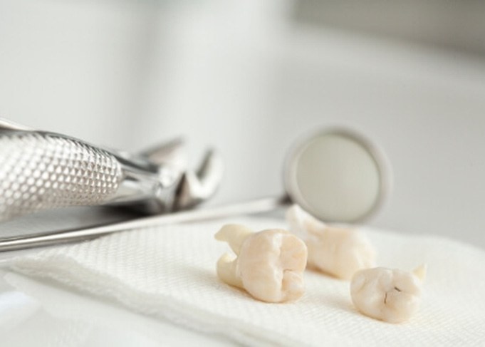 Three teeth resting on napkin on tray with dental instruments